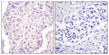 SH-PTP2 rabbit pAb