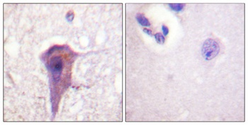 SH-PTP2 rabbit pAb