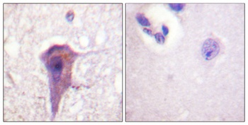 SH-PTP2 antibody