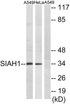 Siah-1/2 rabbit pAb