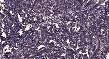 Siah-1/2 rabbit pAb
