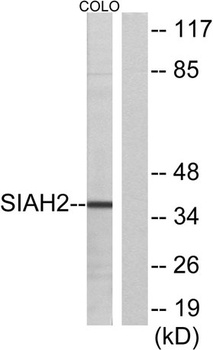 Siah-2 rabbit pAb