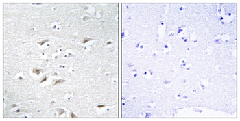 SIP1 antibody