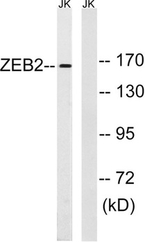 SIP1 antibody