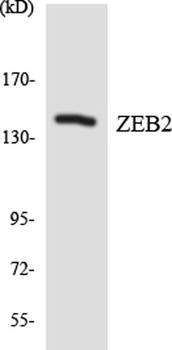 SIP1 antibody