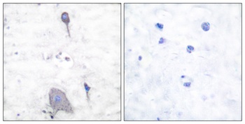 SIRP-alpha 1 antibody