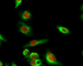 SIRT1 antibody