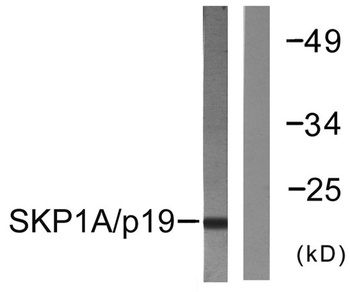 Skp1 p19 rabbit pAb