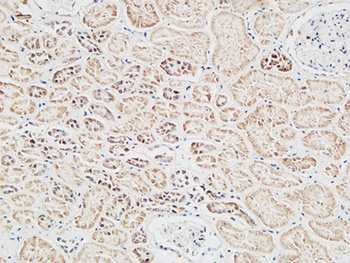 Skp2 p45 antibody