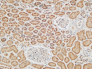 Skp2 p45 antibody