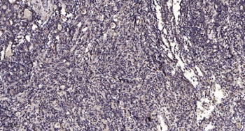 SLC17A2 antibody