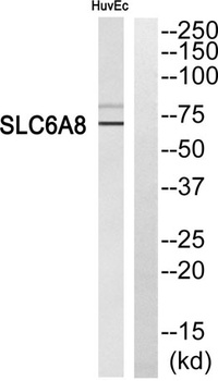 SLC6A8 rabbit pAb