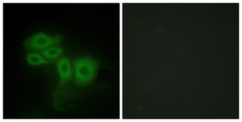 SLK antibody