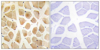 SLK antibody