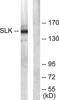 SLK antibody