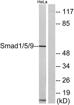 Smad1/5/9 antibody