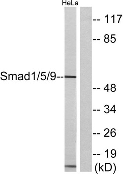 Smad1/5/9 rabbit pAb