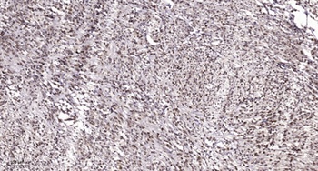 Smad1/5/9 rabbit pAb