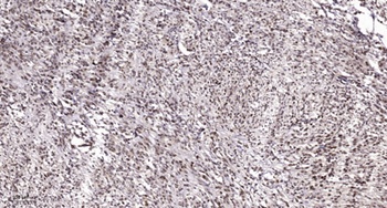 Smad1/5/9 antibody