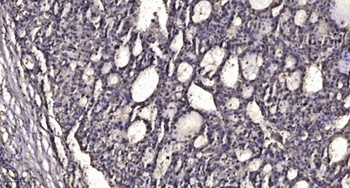 sMtCK antibody