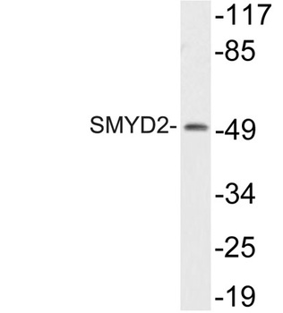 SMYD2 rabbit pAb
