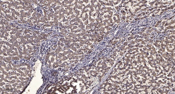 SMYD2 antibody