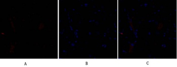 SNAI 1 antibody