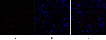 SNAI 1 antibody