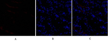 SNAI 1 antibody