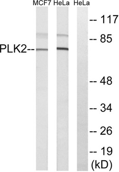 Snk antibody