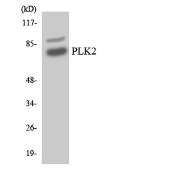 Snk antibody