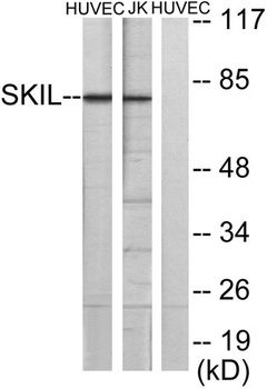 SnoN antibody