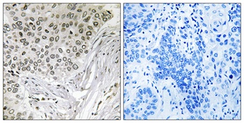 Snrp116 antibody