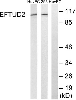 Snrp116 rabbit pAb