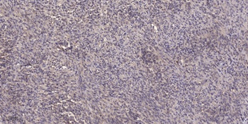 SNX1 antibody