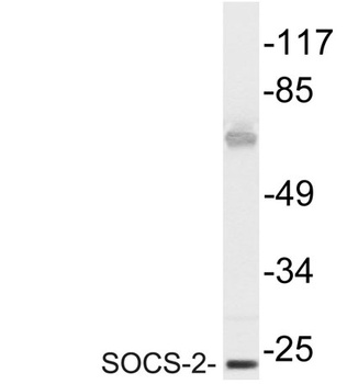 SOCS-2 rabbit pAb
