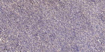 SOCS-2 rabbit pAb