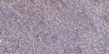 SOCS-2 antibody