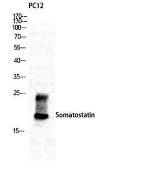 Somatostatin antibody