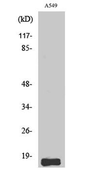 Somatostatin antibody