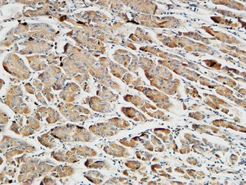 Somatostatin rabbit pAb