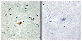 Sox-8/9/17/18 antibody