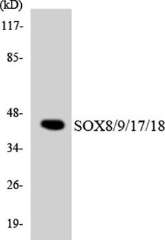 Sox-8/9/17/18 antibody