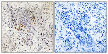 Sp1 antibody