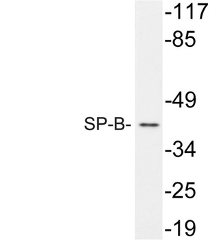 SP-B antibody