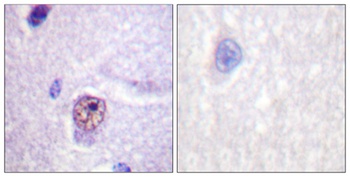 Splicing factor 1 rabbit pAb