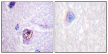 Splicing factor 1 antibody