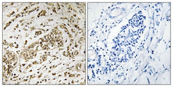 SPT16 antibody