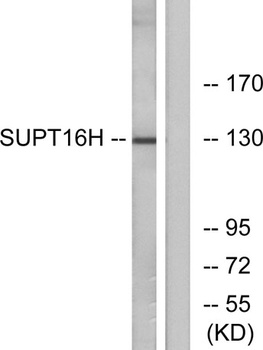SPT16 rabbit pAb
