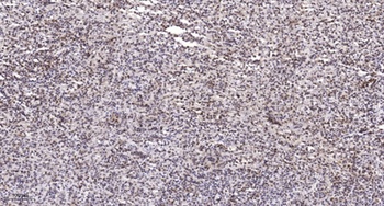 SPT3 antibody